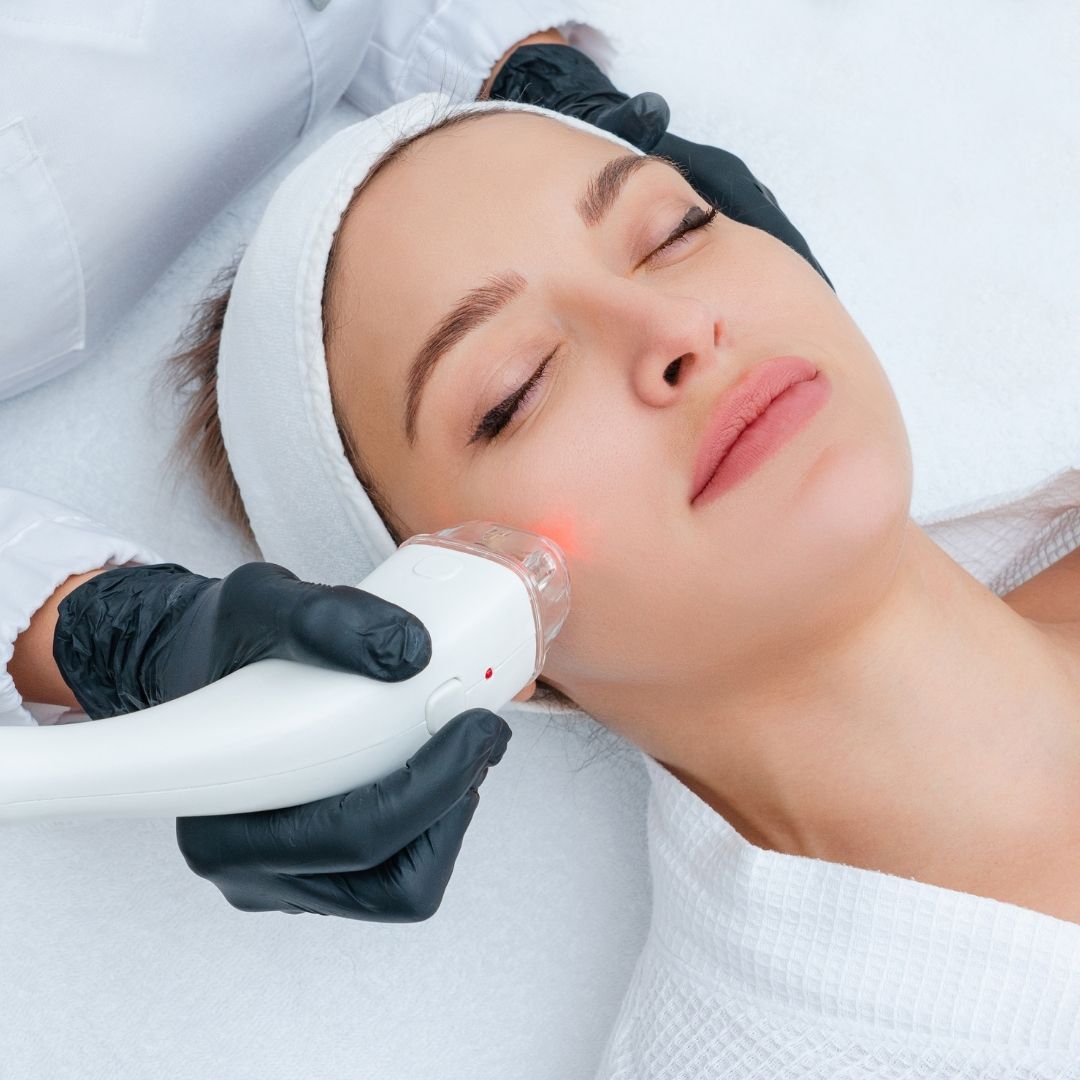 Laser Pigmentation Removal